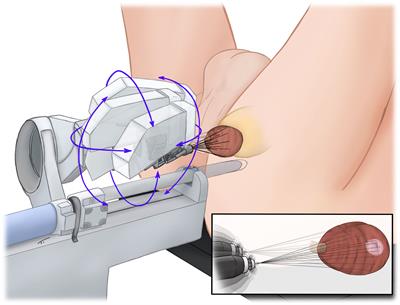 Safety profile of robotic-assisted transperineal MRI-US-fusion guided biopsy of the prostate